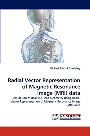 Radial Vector Representation of Magnetic Resonance Image (MRI) data