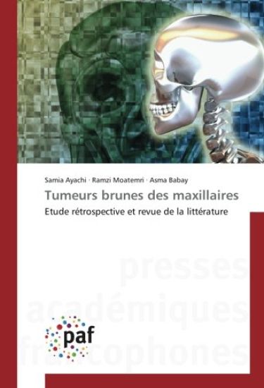 Tumeurs brunes des maxillaires