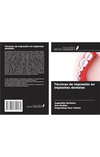Técnicas de impresión en implantes dentales
