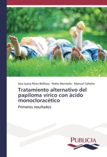 Tratamiento alternativo del papiloma vírico con ácido monocloracético