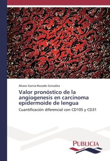 Valor pronóstico de la angiogenesis en carcinoma epidermoide de lengua