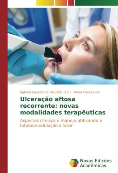 Ulceração aftosa recorrente: novas modalidades terapêuticas