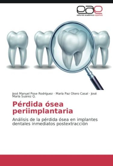 Pérdida ósea periimplantaria