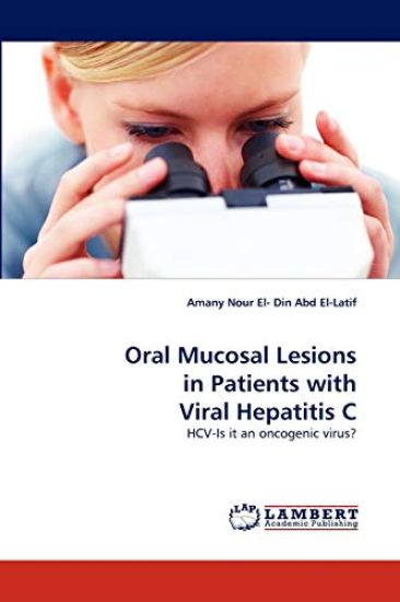 Oral Mucosal Lesions in Patients with Viral Hepatitis C