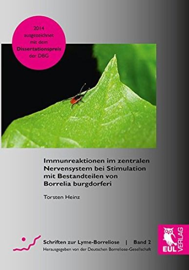 Immunreaktionen im zentralen Nervensystem bei Stimulation mit Bestandteilen von Borrelia burgdorferi