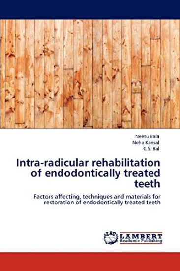 Intra-radicular rehabilitation of endodontically treated teeth