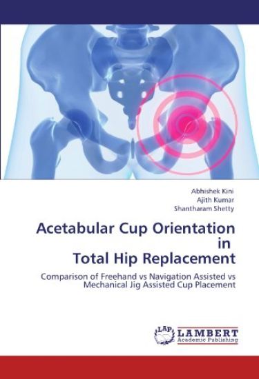 Acetabular Cup Orientation in Total Hip Replacement
