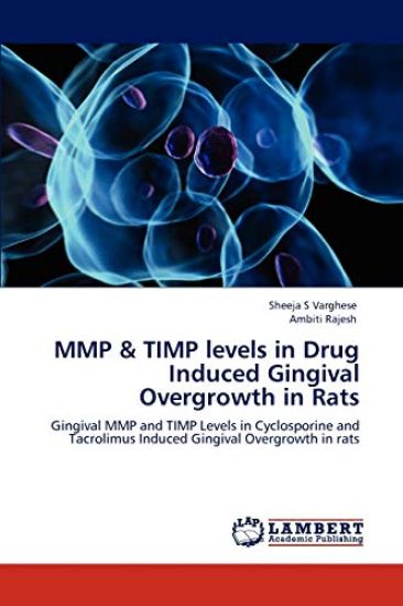 Mmp & Timp Levels in Drug Induced Gingival Overgrowth in Rats