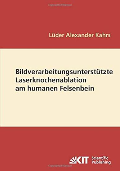 Bildverarbeitungsunterstützte Laserknochenablation am humanen Felsenbein