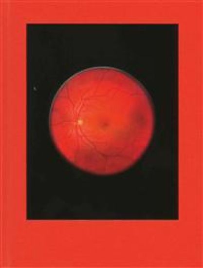 Retinal Shift