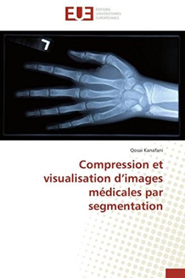 Compression Et Visualisation D Images M?dicales Par Segmentation