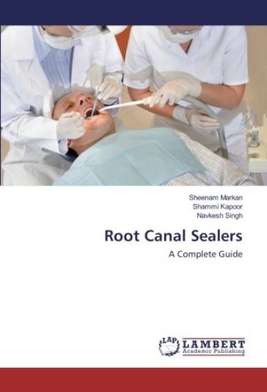 Root Canal Sealers