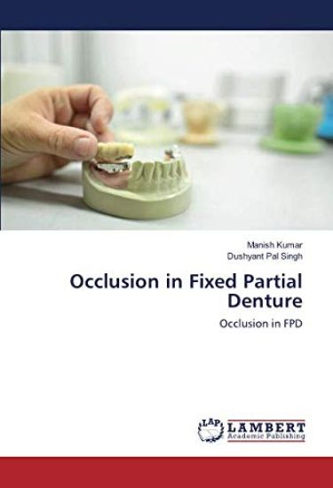 Occlusion in Fixed Partial Denture