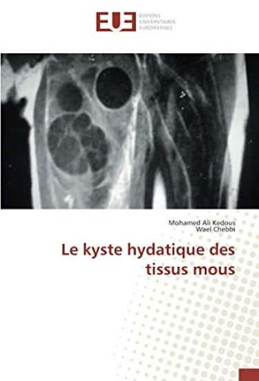 Le kyste hydatique des tissus mous