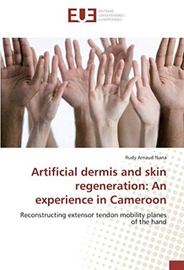 Artificial dermis and skin regeneration: An experience in Cameroon