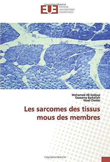 Les sarcomes des tissus mous des membres