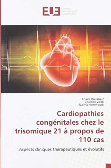 Cardiopathies congénitales chez le trisomique 21 à propos de 110 cas
