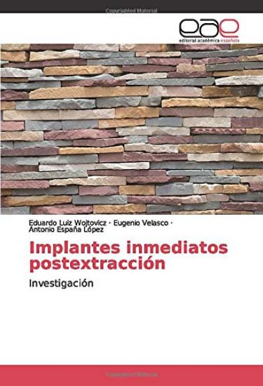 Implantes inmediatos postextracción