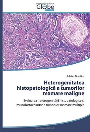 Heterogenitatea histopatologic¿ a tumorilor mamare maligne