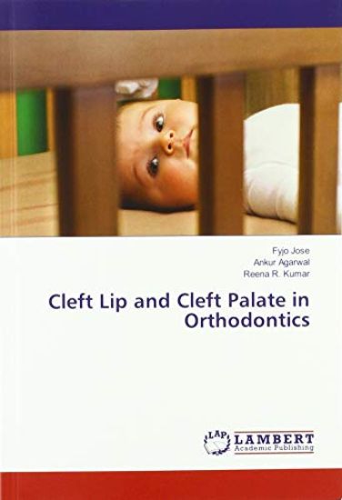 Cleft Lip and Cleft Palate in Orthodontics
