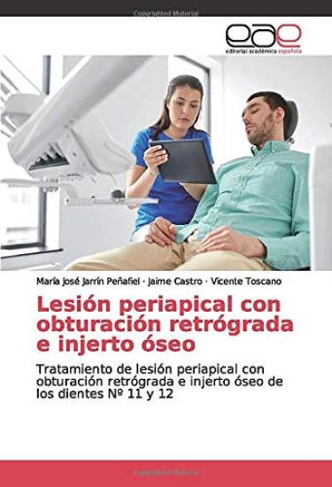 Lesión periapical con obturación retrógrada e injerto óseo