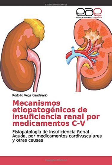 Mecanismos etiopatogénicos de insuficiencia renal por medicamentos C-V