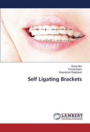 Self Ligating Brackets