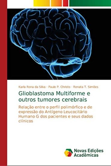Glioblastoma Multiforme e outros tumores cerebrais