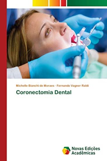 Coronectomia Dental