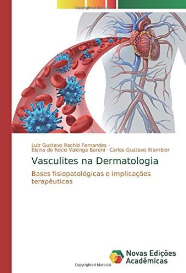 Vasculites na Dermatologia
