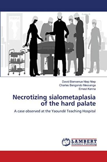 Necrotizing sialometaplasia of the hard palate