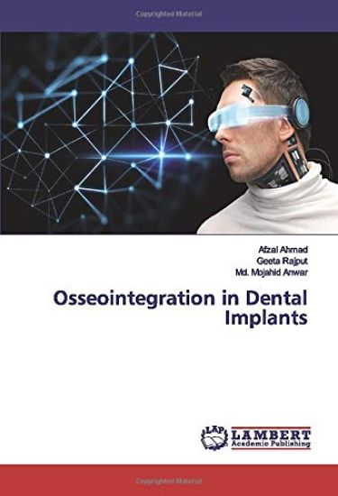 Osseointegration in Dental Implants