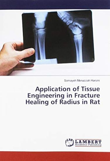 Application of Tissue Engineering in Fracture Healing of Radius in Rat