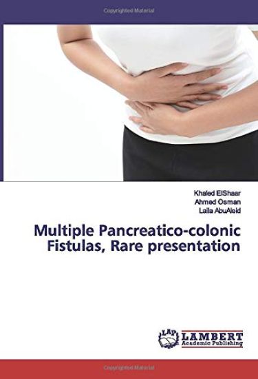 Multiple Pancreatico-colonic Fistulas, Rare presentation
