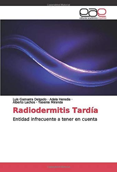 Radiodermitis Tardía