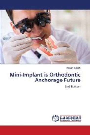 Mini-Implant is Orthodontic Anchorage Future