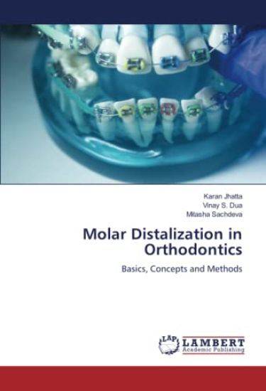Molar Distalization in Orthodontics