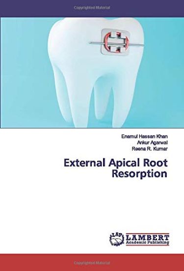 External Apical Root Resorption