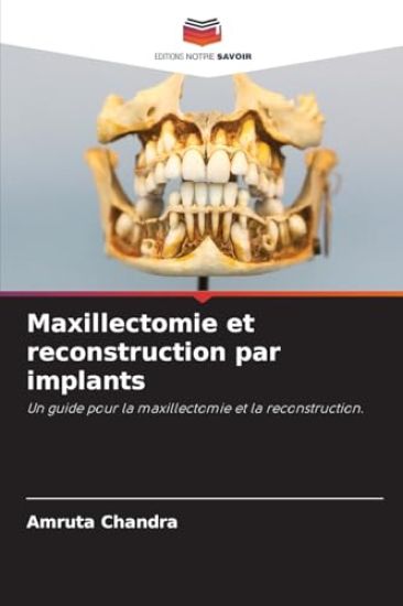 Maxillectomie et reconstruction par implants