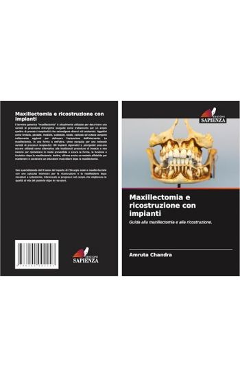 Maxillectomia e ricostruzione con impianti