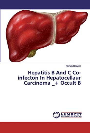 Hepatitis B And C Co-infecton In Hepatocellaur Carcinoma _+ Occult B