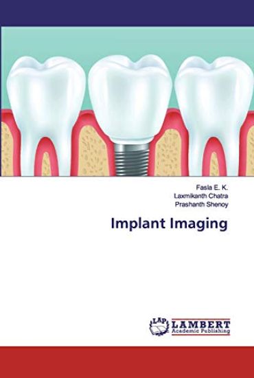 Implant Imaging