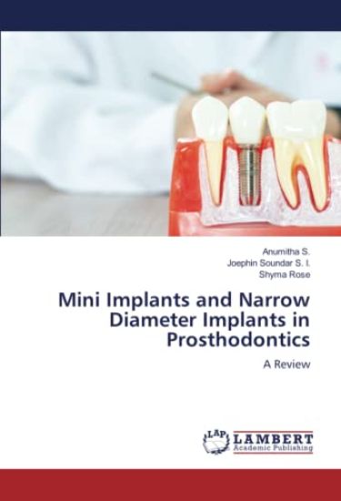 Mini Implants and Narrow Diameter Implants in Prosthodontics