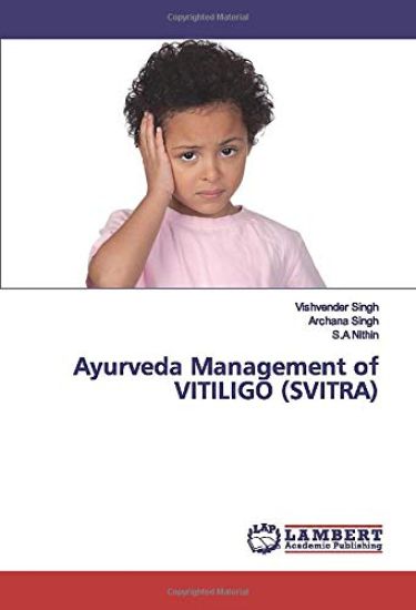 Ayurveda Management of VITILIGO (SVITRA)