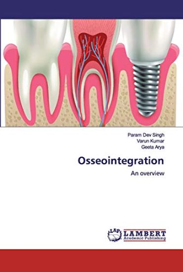 Osseointegration