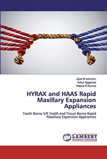 HYRAX and HAAS Rapid Maxillary Expansion Appliances