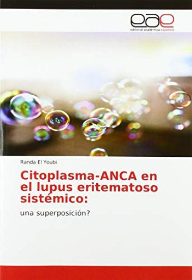 Citoplasma-ANCA en el lupus eritematoso sistémico: