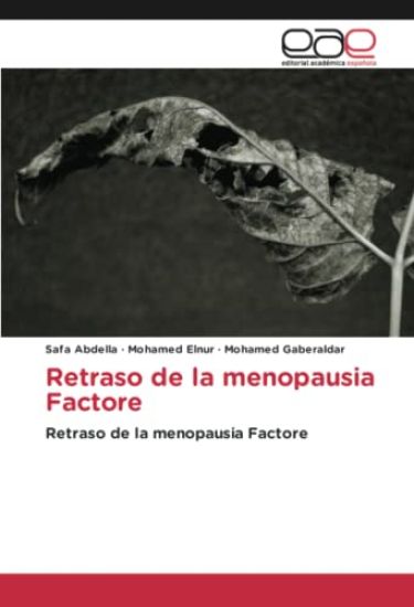 Retraso de la menopausia Factore
