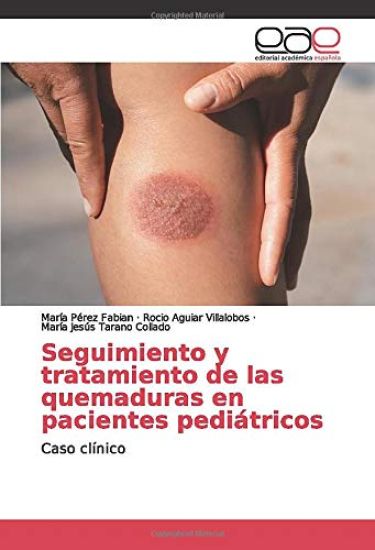 Seguimiento y tratamiento de las quemaduras en pacientes pediátricos