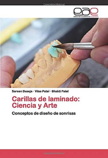 Carillas de laminado: Ciencia y Arte